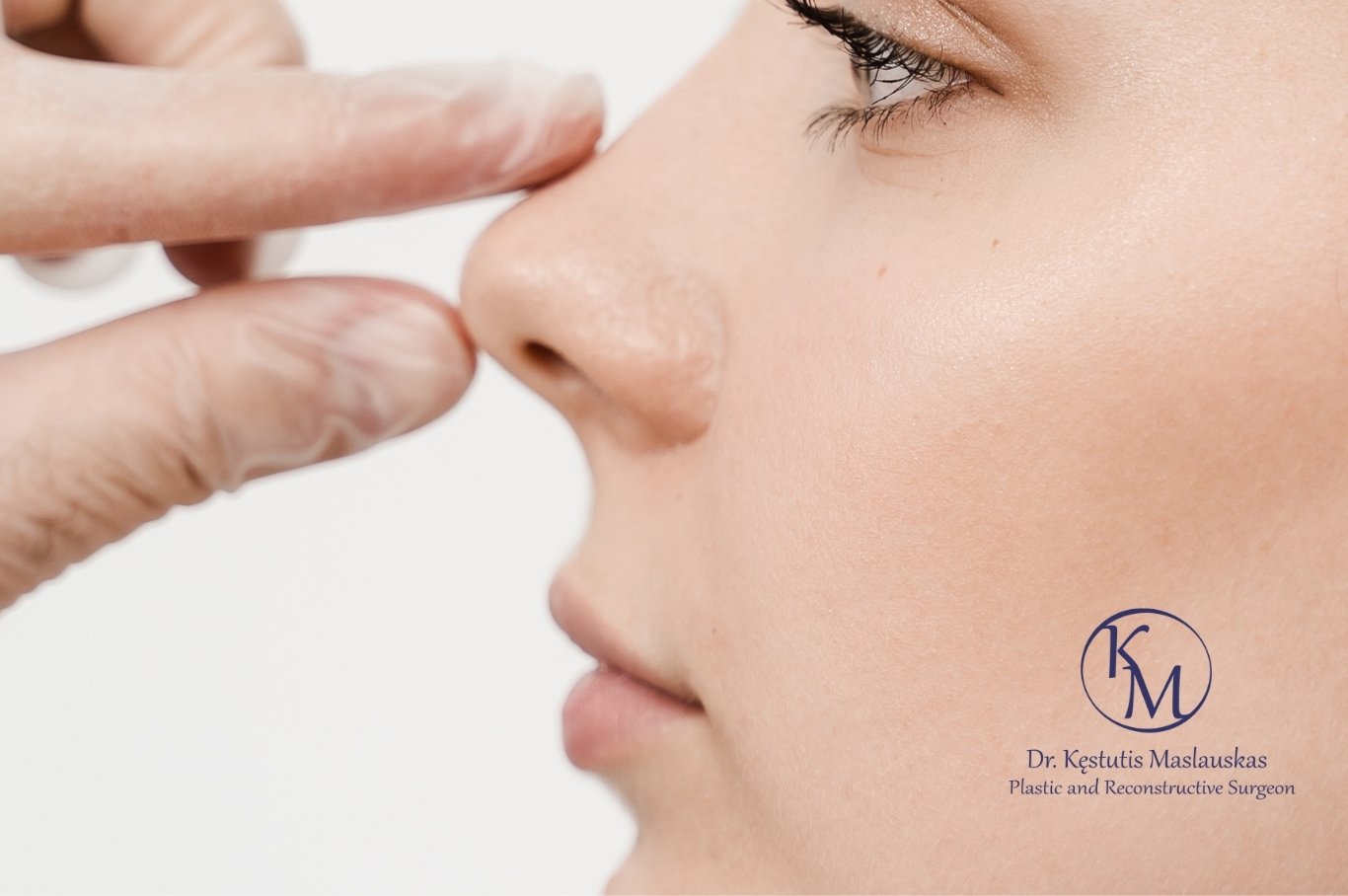 Moters veido profilis po to, kai buvo atlikta rinoplastika, matomas nosies fragmentas ir gydytojo ranka.